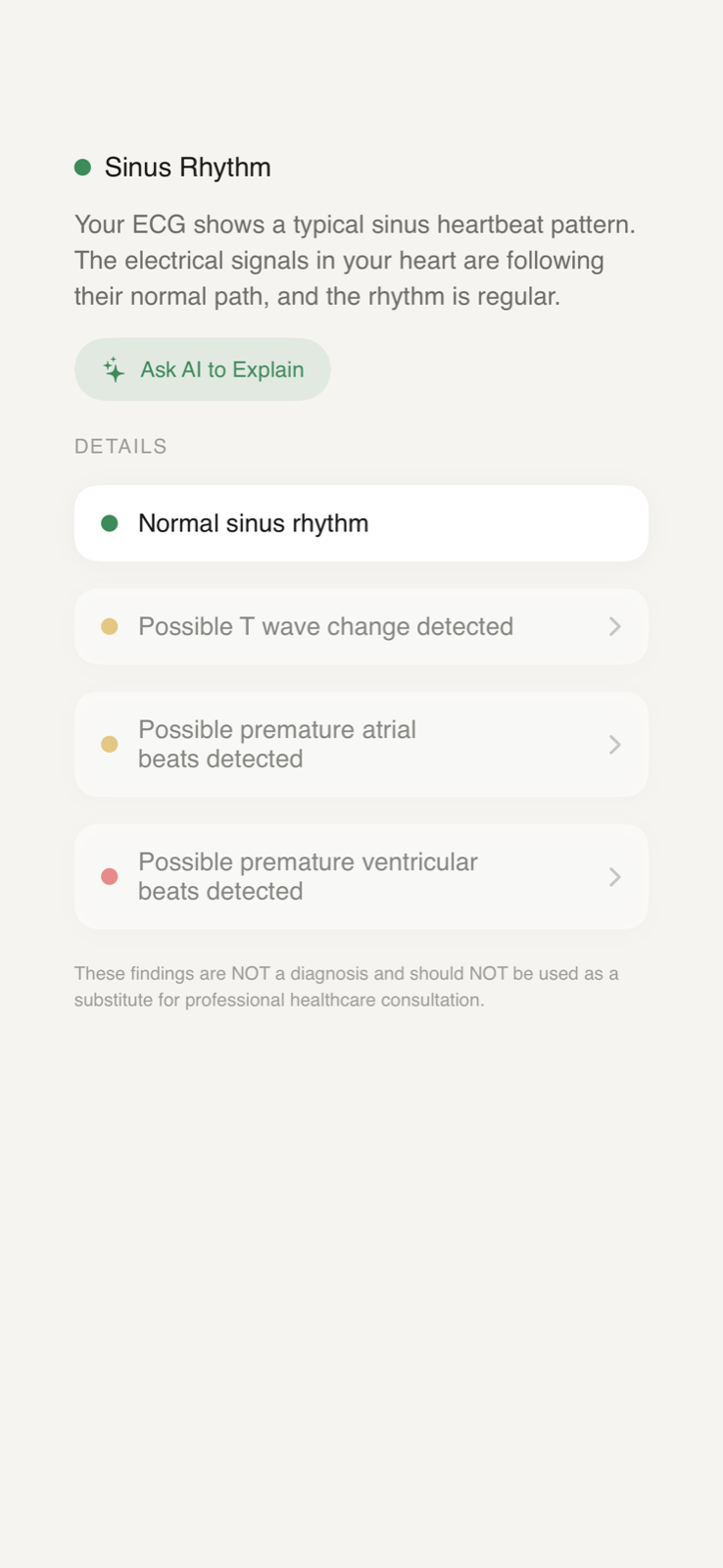 AI explanation of an ECG finding in plain English