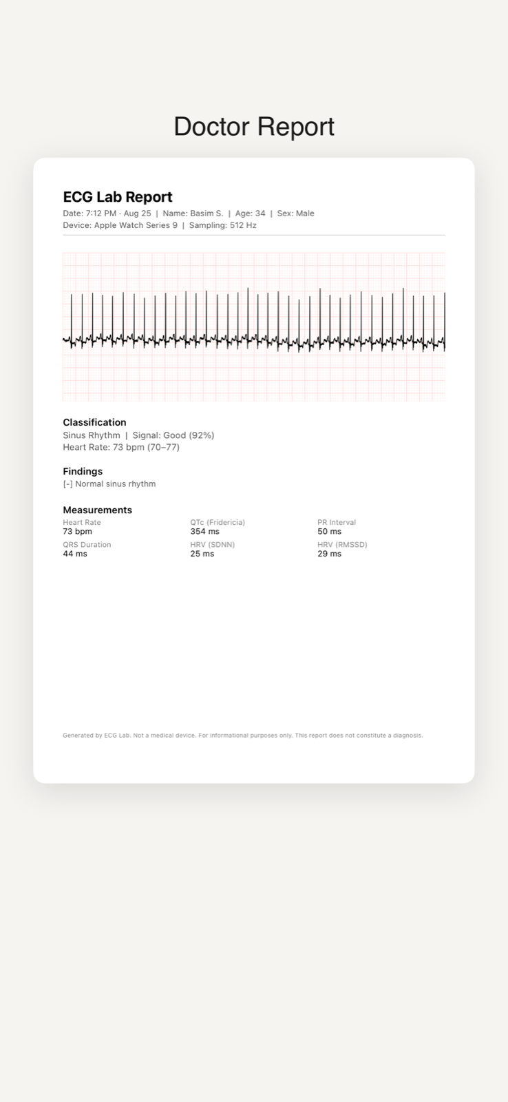 PDF report export of an ECG recording